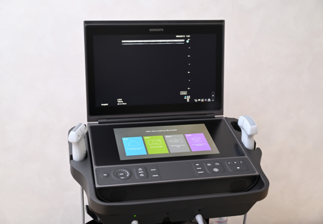 超音波画像診断装置